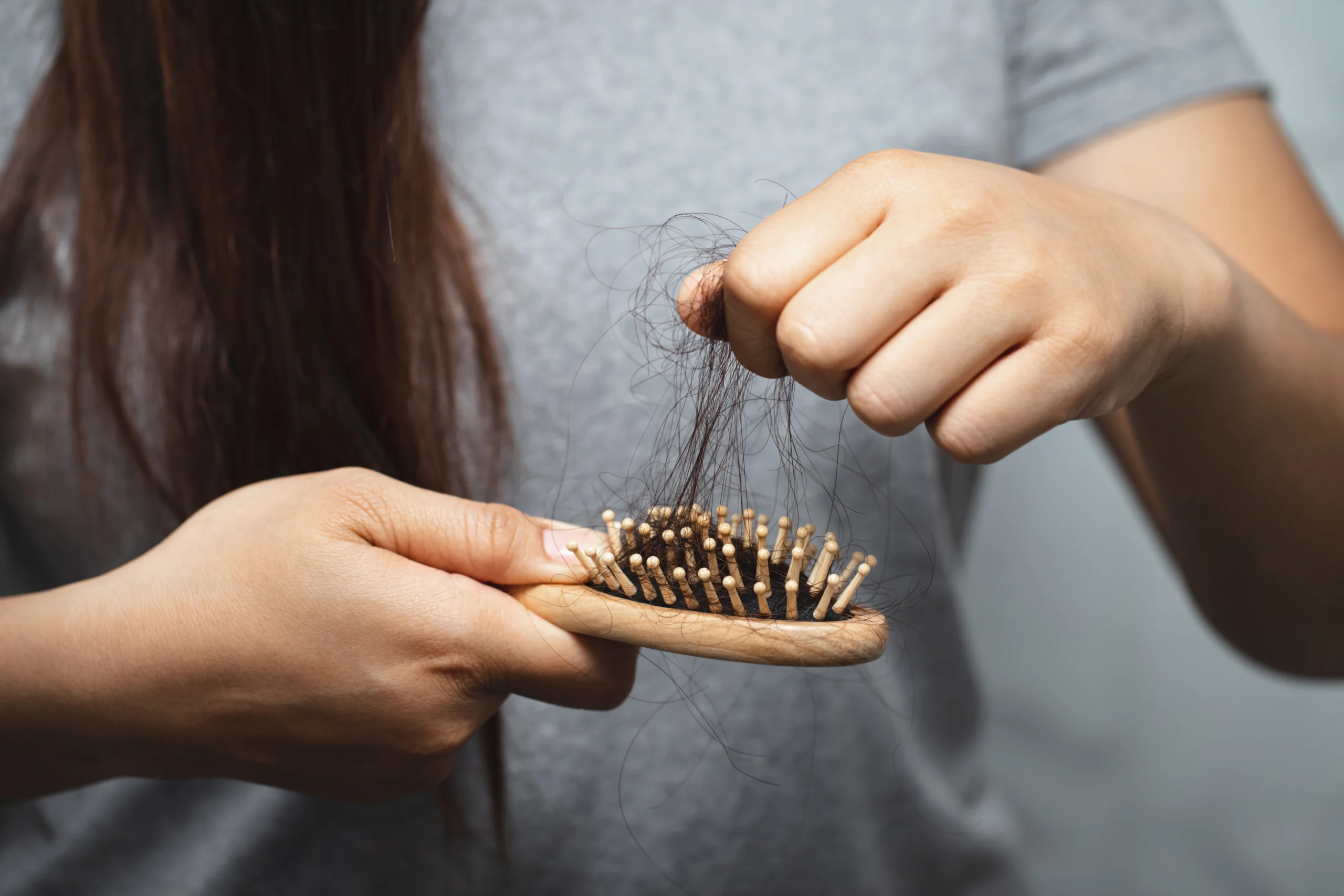 caduta dei capelli